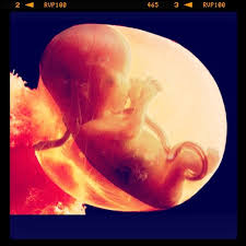 fetus in the womb