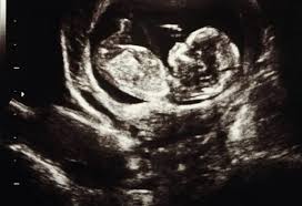 baby in ultrasound